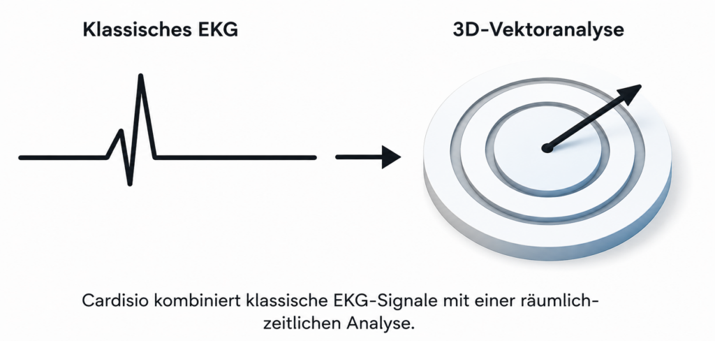 Vergleich eines klassischen EKG-Signals mit der räumlich-zeitlichen 3D-Vektoranalyse von Cardisio