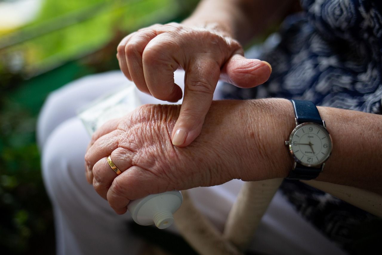 Hände mit sichtbaren Gelenkveränderungen bei rheumatoider Arthritis